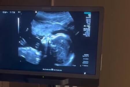 VIDEO | Captan a feto “cantando” durante ultrasonido y sorprende a todos en redes sociales